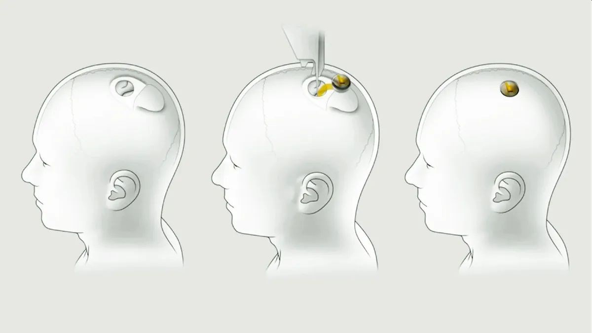 Neuralink tehlikeli madde taşıma kurallarını ihlal etti