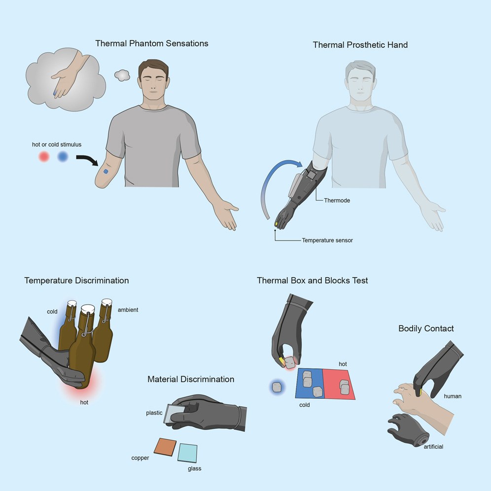 Bu devrimsel protez el ile sıcaklık ve dokunuş hissedilebiliyor