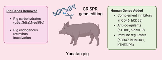 Genetiği değiştirilmiş domuz böbreği ilk kez insana nakledildi