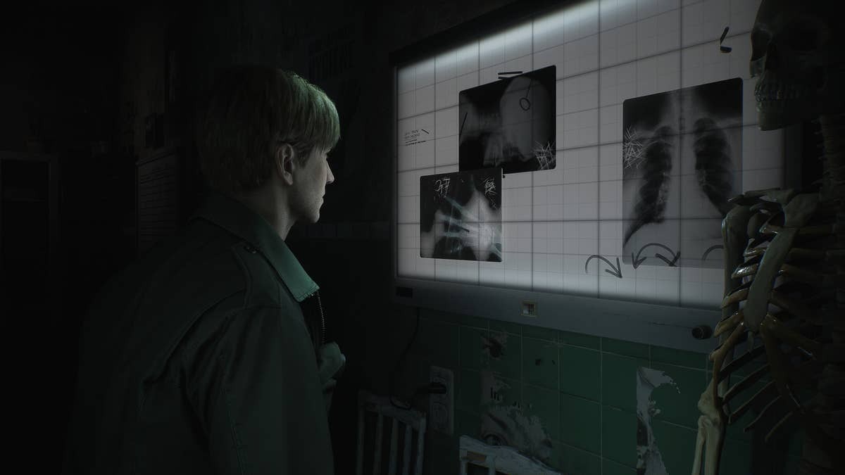 Silent Hill 2 Remake - inceleme
