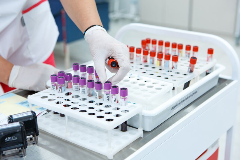 Avustralya'daki bir laboratuvarda 323 şişe ölümcül virüs kayboldu