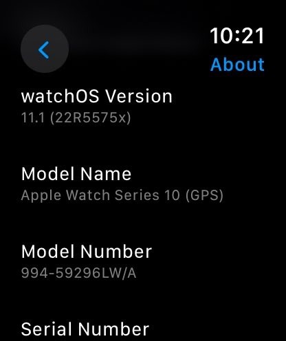 Apple Watch Series 10 prototipinde yeni sağlık sensörü göründü