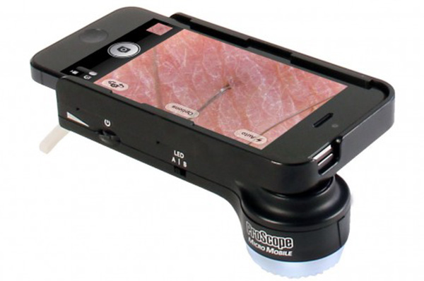 Apple'ın iPad, iPod ve iPhone modelleri ile 20-80 kat arası büyütme sağlayan kamera aparatı, 'ProScope'