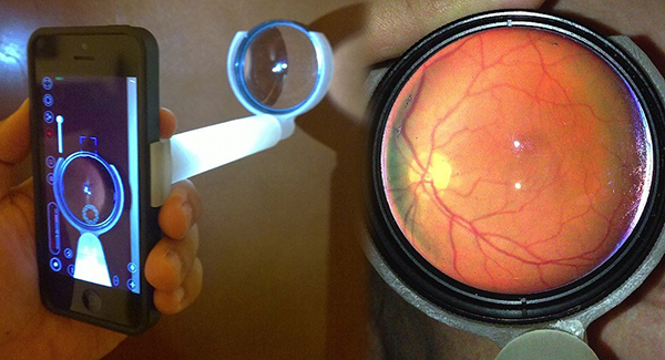 EyeGo isimli adaptör ile akıllı telefonlar üzerinden 'sağlık amaçlı' göz taraması yapılabiliyor