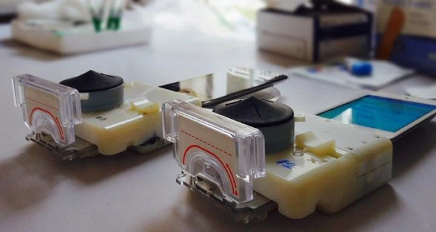 Akıllı telefonlar için geliştirilen yeni bir aparat ile 15 dakikada HIV testi yapılabiliyor