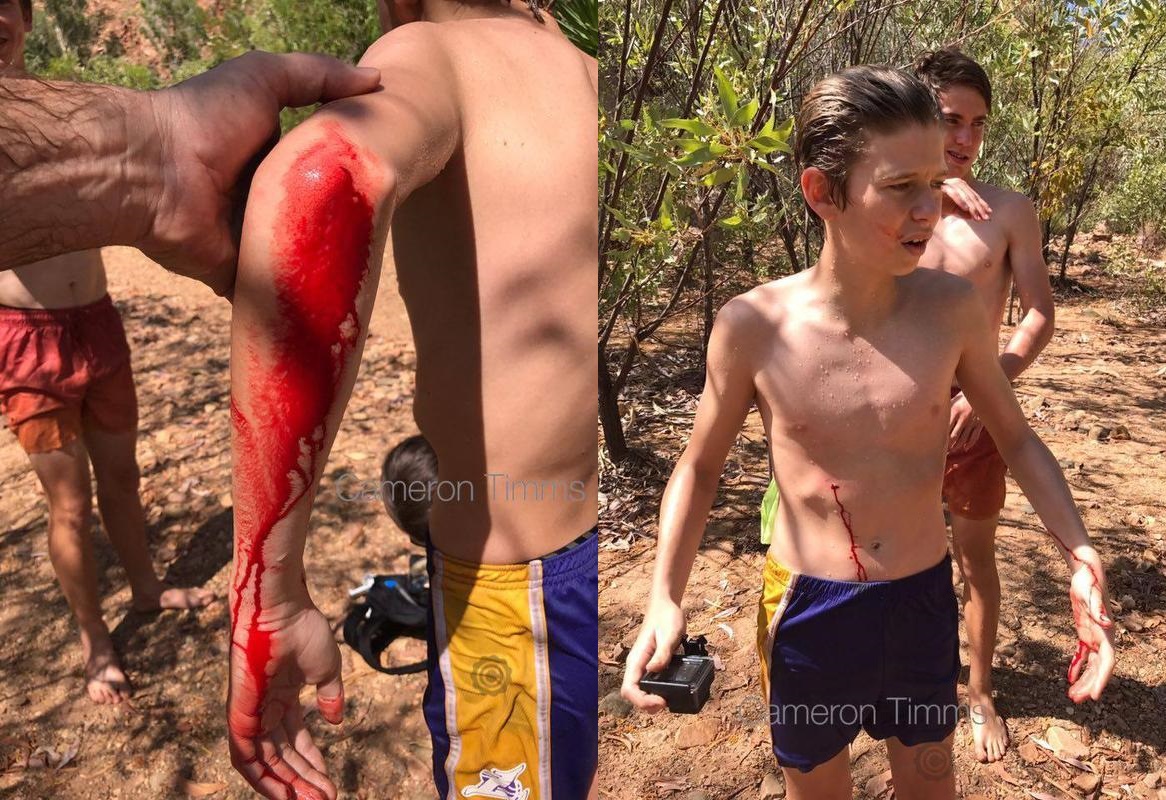 Çocuğu ısıran timsah saldırı öncesi etrafında yüzerken GoPro'ya yakalandı