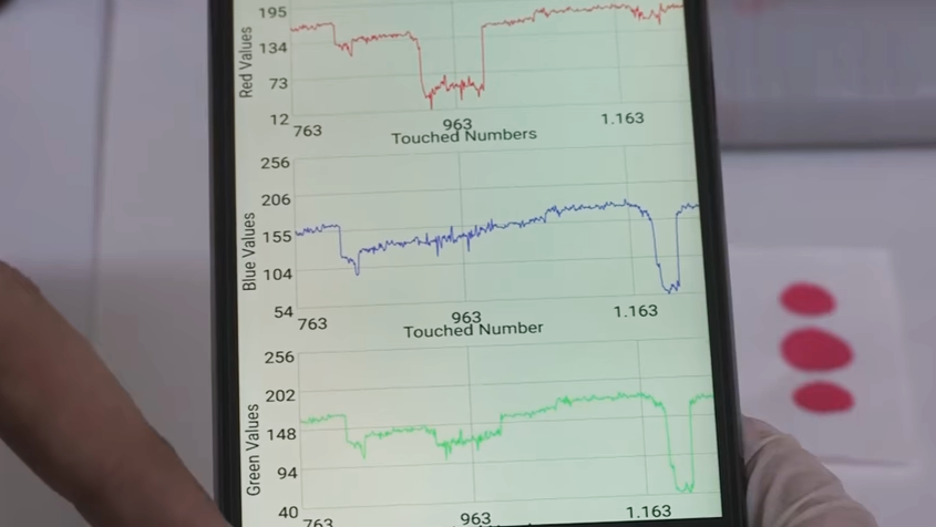 Cep telefonuyla kan tahlili yapılmasını sağlayan uygulama geliştirildi