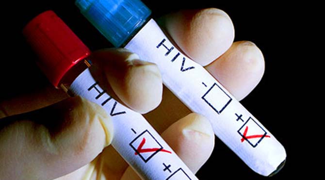 Yeni keşif AIDS tedavisinin etkisini arttırabilir