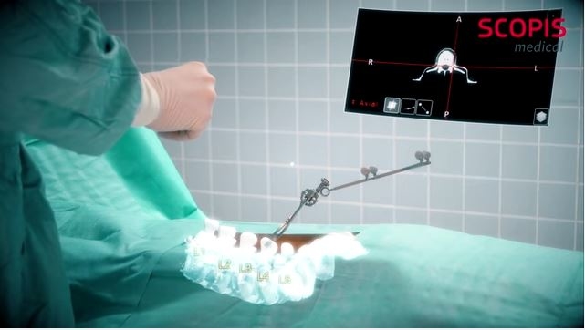 Microsoft HoloLens, ameliyatlarda cerrahlara yardımcı olacak