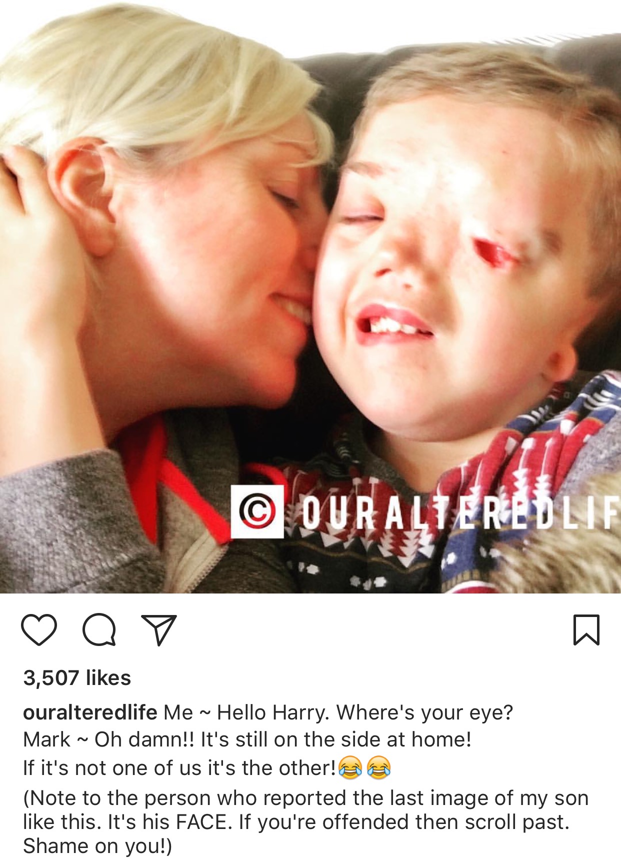 Instagram, fotoğrafını kaldırdığı çocuğun ailesinden özür diledi