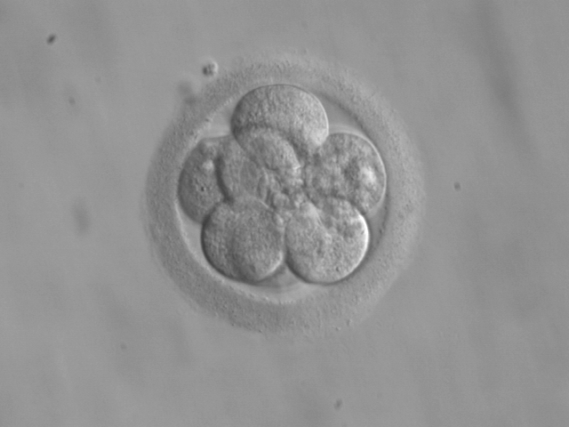 Anöploid embriyodan sağlıklı birey gelişebilir mi? Bir başarı hikayesi