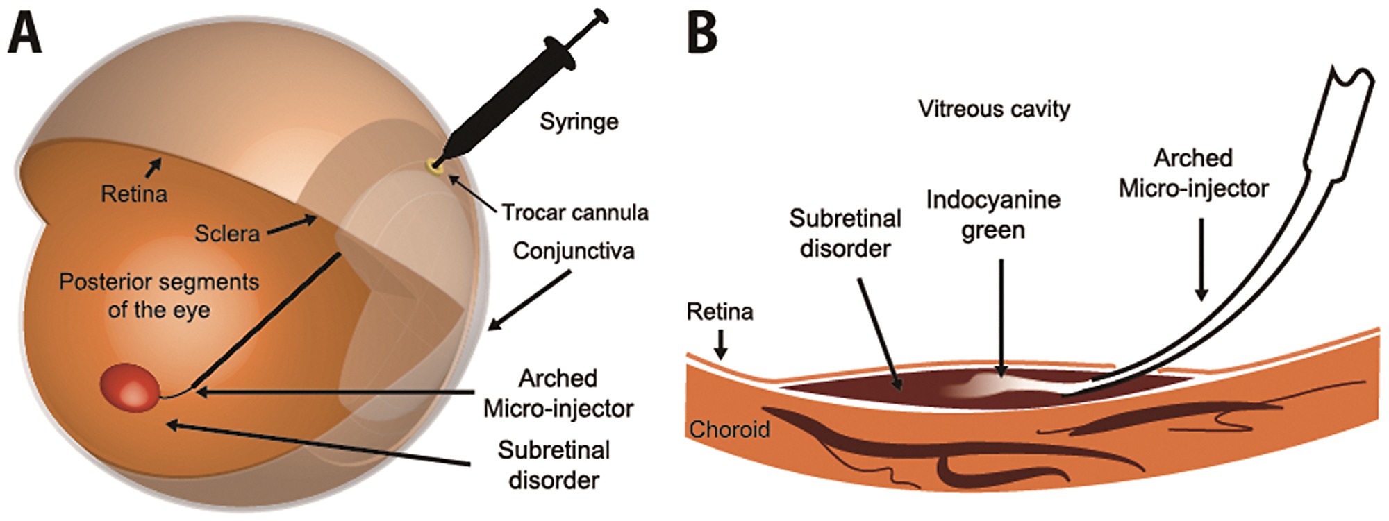 Retinal Distrofinin genetik tedavisine FDA’dan onay geldi