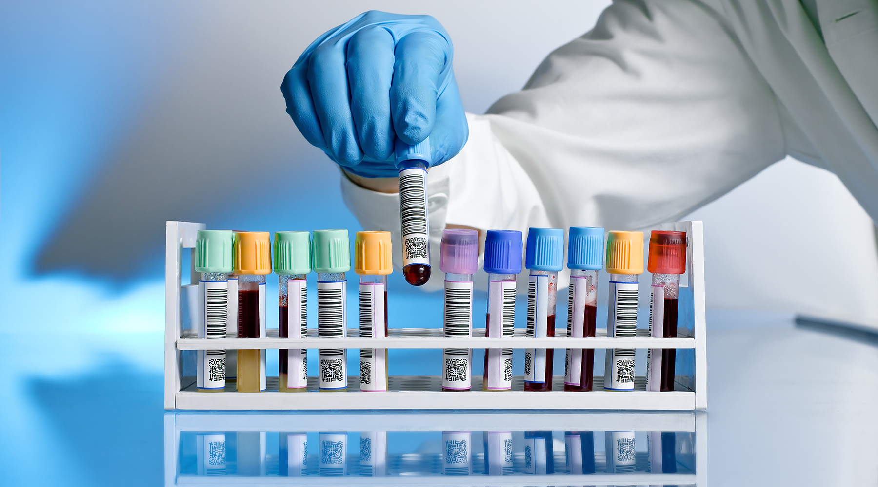 Otizm Spektrum Bozukluğu teşhisi için kan testi geliştirildi