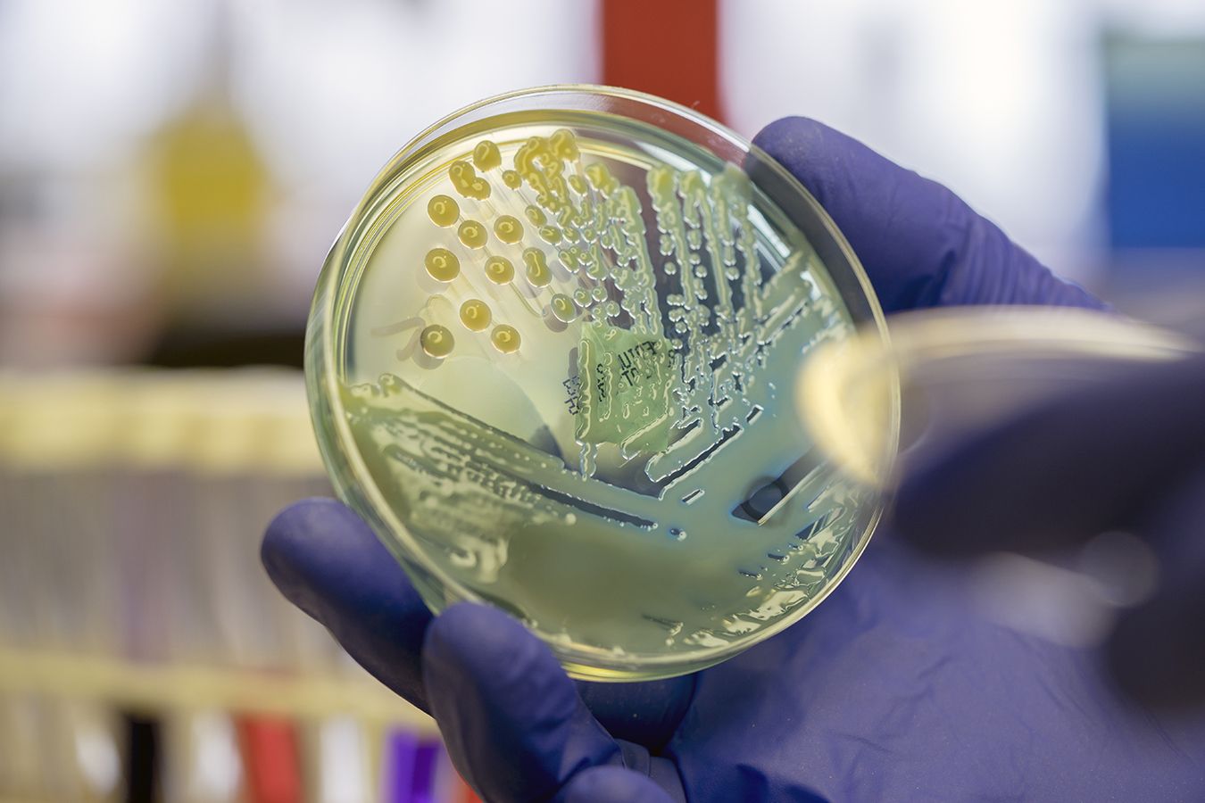 Bakteriler antibiyotiklere karşı artık çok daha dirençli